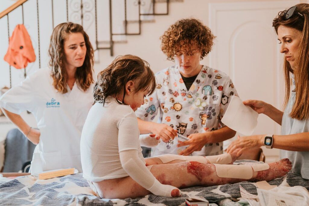 Curación de la piel de Mariposa 